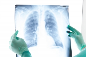The Growing Demand for Locum Radiographers: A Look at General X-Ray, MRI, and CT Candidates